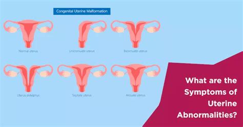 Understanding the Symptoms of Uterine Abnormalities | Nova IVF Fertility