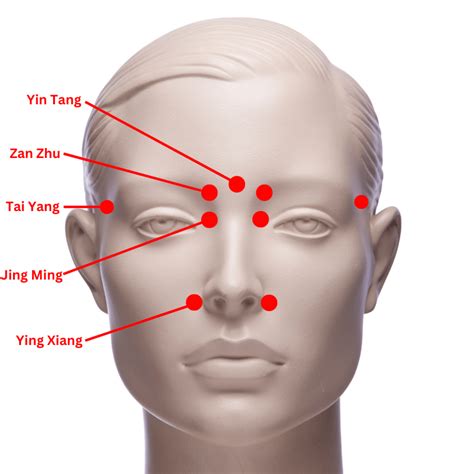 Acupuncture for Sinus Headaches: A Proven Treatment