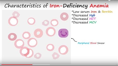 Stages Of Iron Deficiency Anemia