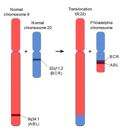 Leukemia Granulositik Kronik (LGK) atau Chronic Myelogenous Leukemia (CML) – Kedokteran – Caiherang