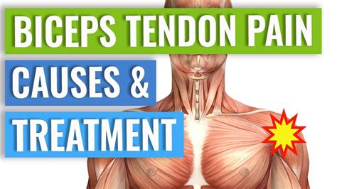 Biceps Tendonitis Treatment and Exercises Explained - YouTube