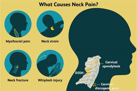 Common Causes for Neck Pain - Our Medical Blog