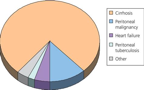 59: Ascites and its complications | Abdominal Key