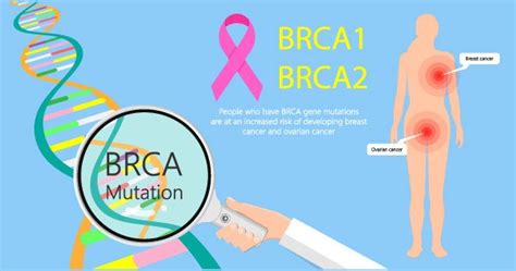 The BRCA1 and BRCA2 Gene Mutations Kill Post-Mortem DNA Testing Saves ...