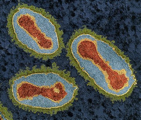 Smallpox viruses - Stock Image M050/0725 - Science Photo Library