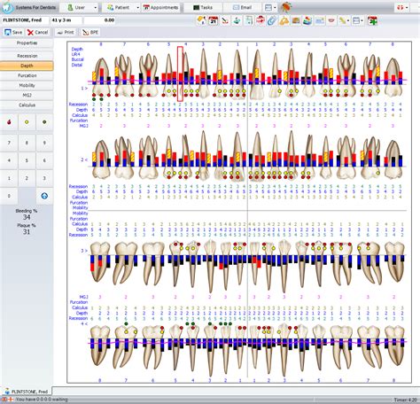 Perio Charting Chart