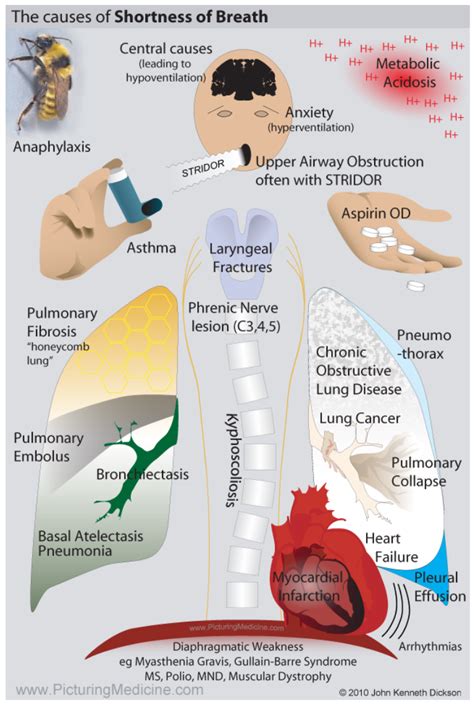 What is Asthma?