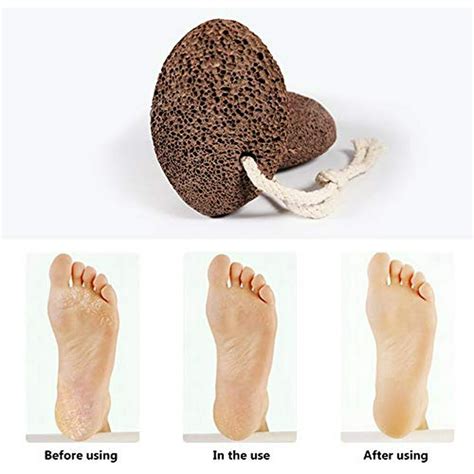 Pumice Stone for feet scrubber - Foot scrubber scrub dead skin removal – Natural Lava pumice ...