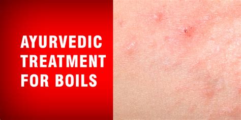 Ayurvedic treatment for boils - Dr. Brahmanand Nayak