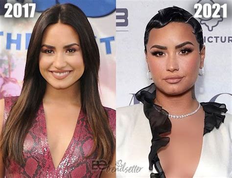 Demi Lovato Plastic Surgery Before and After Photos, Secrets