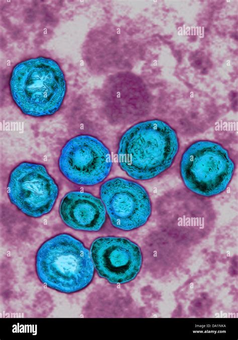 CYTOMEGALOVIRUS Stock Photo - Alamy