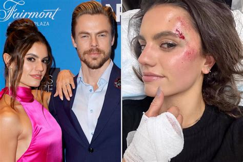 Derek Hough and Hayley Erbert Say They Are 'Both Okay' After 'Scary' Car Accident