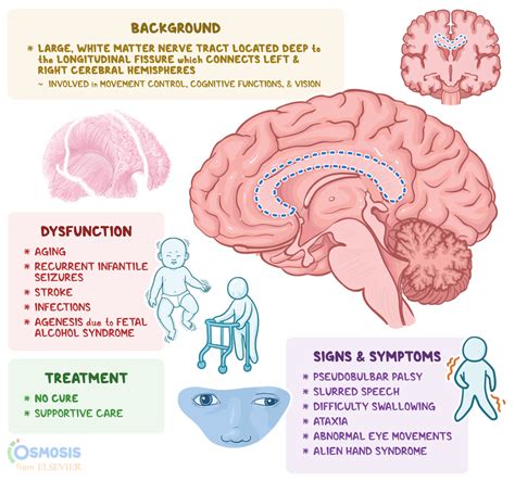 Corpus Callosum: What Is It, Location, Function, and More