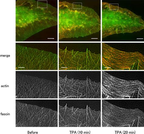 Fascin in lamellipodia contributes to cell elasticity by controlling the orientation of ...