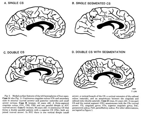 Anterior cingulate — Practice and theory of brain imaging