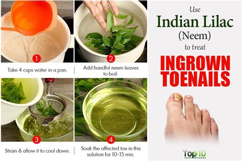 Home Remedies for Ingrown Toenails