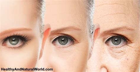 Under Eye Wrinkles: Causes, Natural Treatments and Prevention