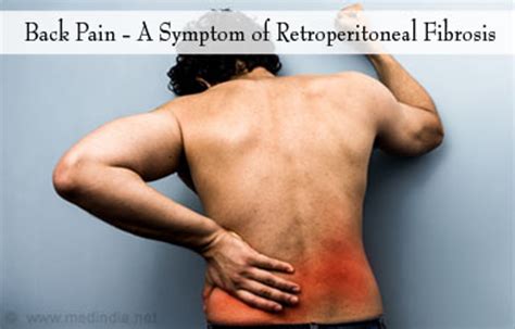 Retroperitoneal Fibrosis | Ormond's Disease - Causes, Diagnosis, and Treatment