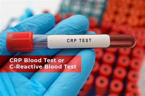 Learn About CRP Blood test or C-Reactive Protein blood test