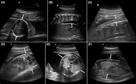 First Detailed Ultrasound Images of Pregnant Dolphins Are Both ...