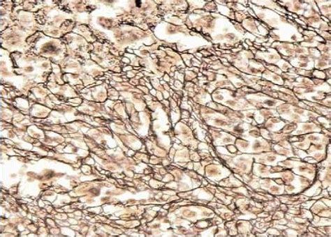 Reticular Connective Tissue Function and Location - Jotscroll