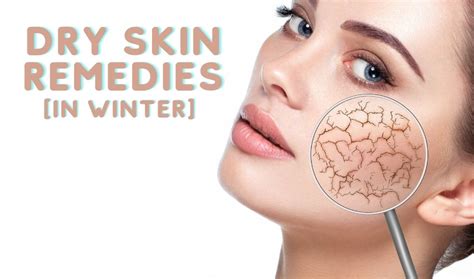 4 Natural Homemade Face Packs for Dry Skin in Winter - BeautySutras