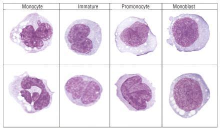 Monocyte morphology and maturation | Hematology, Medical laboratory, Medical laboratory science