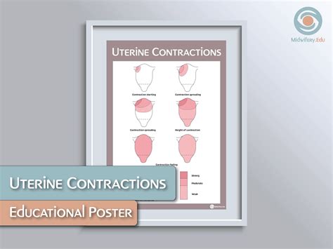 Uterine Contractions Educational Poster - Etsy