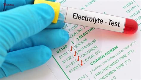 Serum Electrolyte Test. 6 major electrolytes for testing