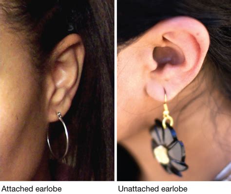 Unattached Earlobes