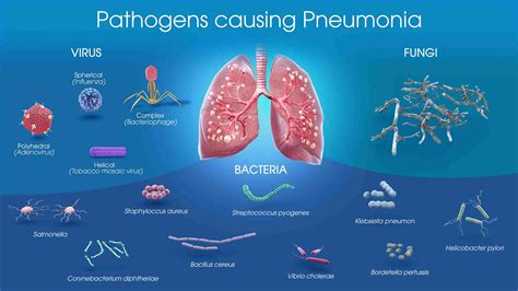 Pneumonia Virus Diagram