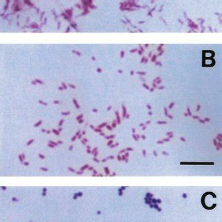 Bartonella henselae-associated conjunctivitis. Granulomatous nodules on... | Download Scientific ...