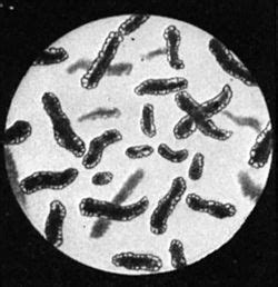 Archaebacteria - King of Kingdoms