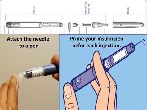 Insulin Injection Technique