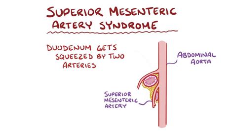 Cranial Mesenteric Artery