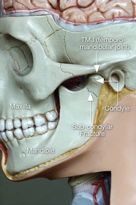 Jaw Pain | Dear Doctor - Dentistry & Oral Health