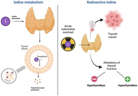 Hypothyroidism Diet Iodine | 7petals.in