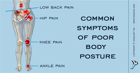 What Is Malalignment Syndrome? | MASS4D® Insoles - MASS4D® Foot Orthotics