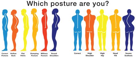 Look and Feel Better By Having Your Posture Corrected