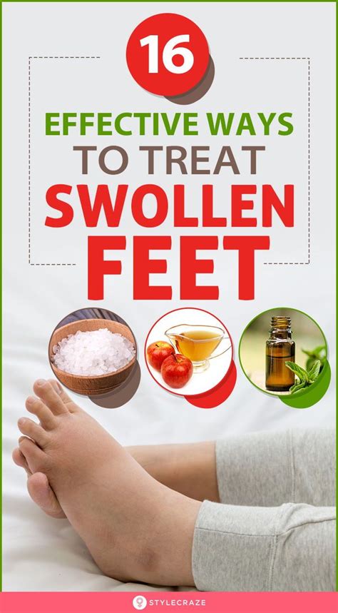 16 home remedies for swollen feet symptoms and treatments – Artofit