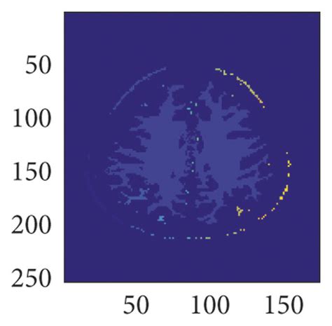 Fully automatic gray and white matter segmentation in brain MRI images ...