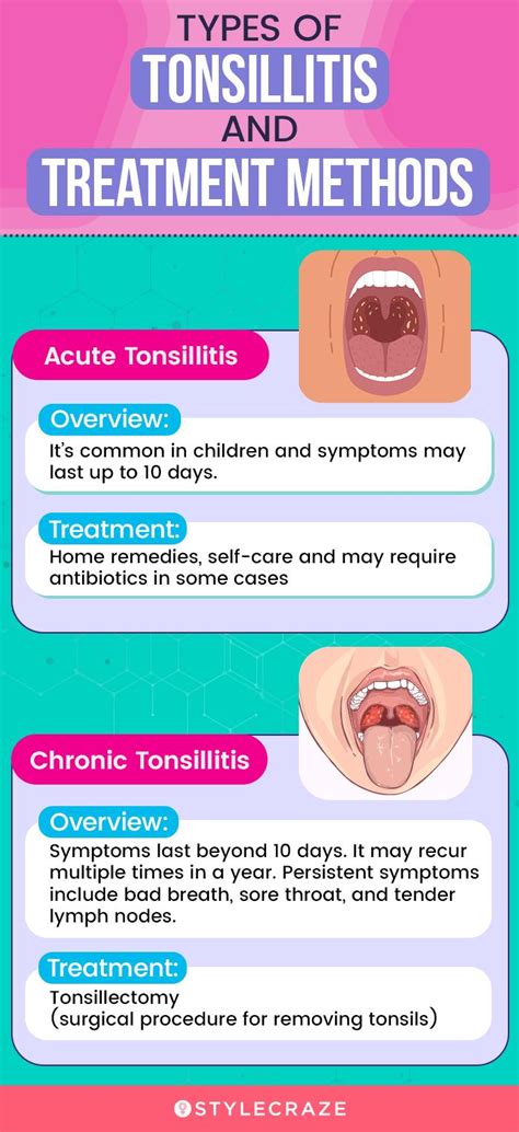 Tonsils Treatment At Home