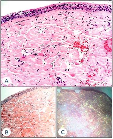 Vocalis Muscle Histology