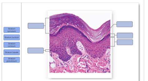 Solved Stratum spinosum Stratum lucidum Stratum corneum | Chegg.com