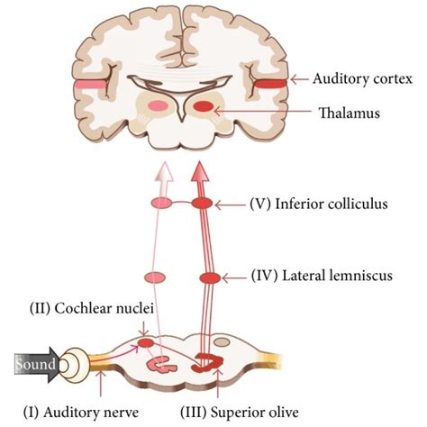 The auditory brainstem response to 500 HZ tone burst (ABR500 HZ) in a... | Download Scientific ...