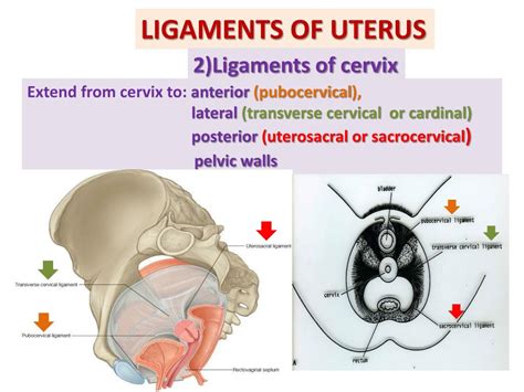 Transverse Cervical Ligament Of Uterus