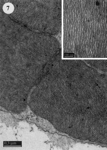 Giant mitochondria in the retina cone inner segments of shrews of genus Sorex (Insectivora ...