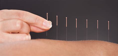 Acupuncture For Cancer - Legacy Clinic of Chiropractic