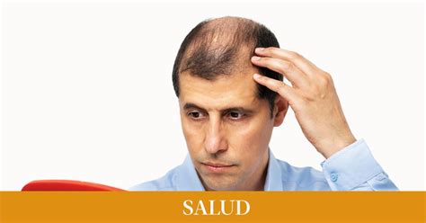 Side effects of Finasteride, the medicine to prevent hair loss - Time News