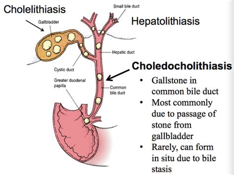 Cholangitis Triad